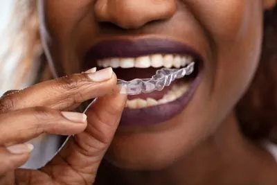 woman putting in her new clear aligners that she received from Uptown Family Dental